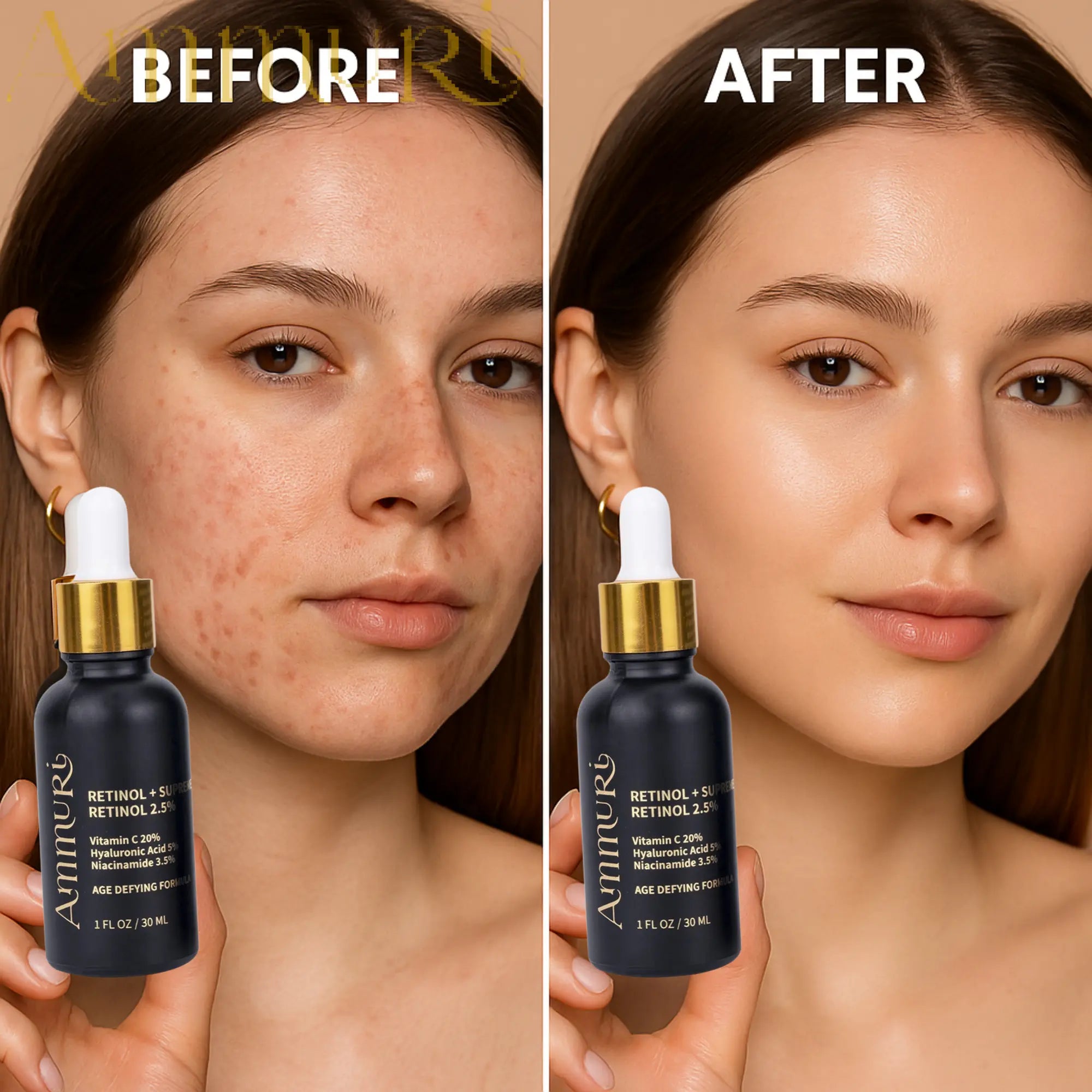 Ammuri 2.5% Retinol Serum - Gentle Anti-Aging Treatment Ammuri Skincare