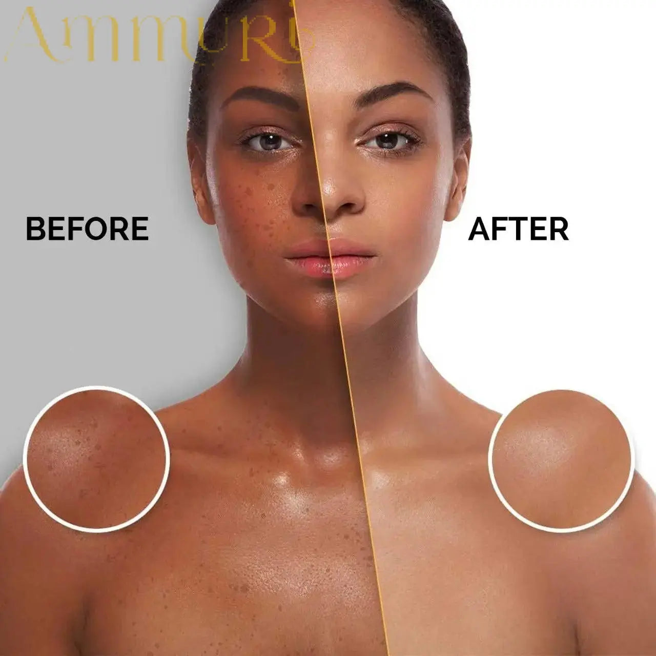 Ammuri Skincare extreme whitening serum before and after results showing improved skin tone and clarity.