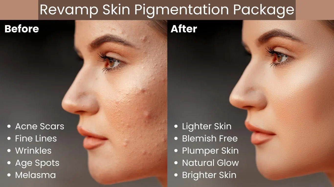 Revamp Skin Pigmentation Package 2 Ammuri Skincare