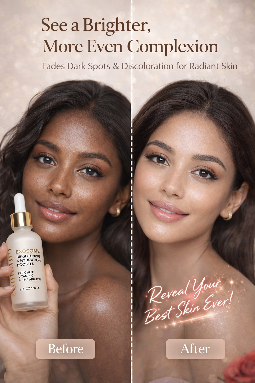 Ammuri Exosome Booster Serum - Brightening Face Serum with Kojic Acid 30ml Ammuri Skincare