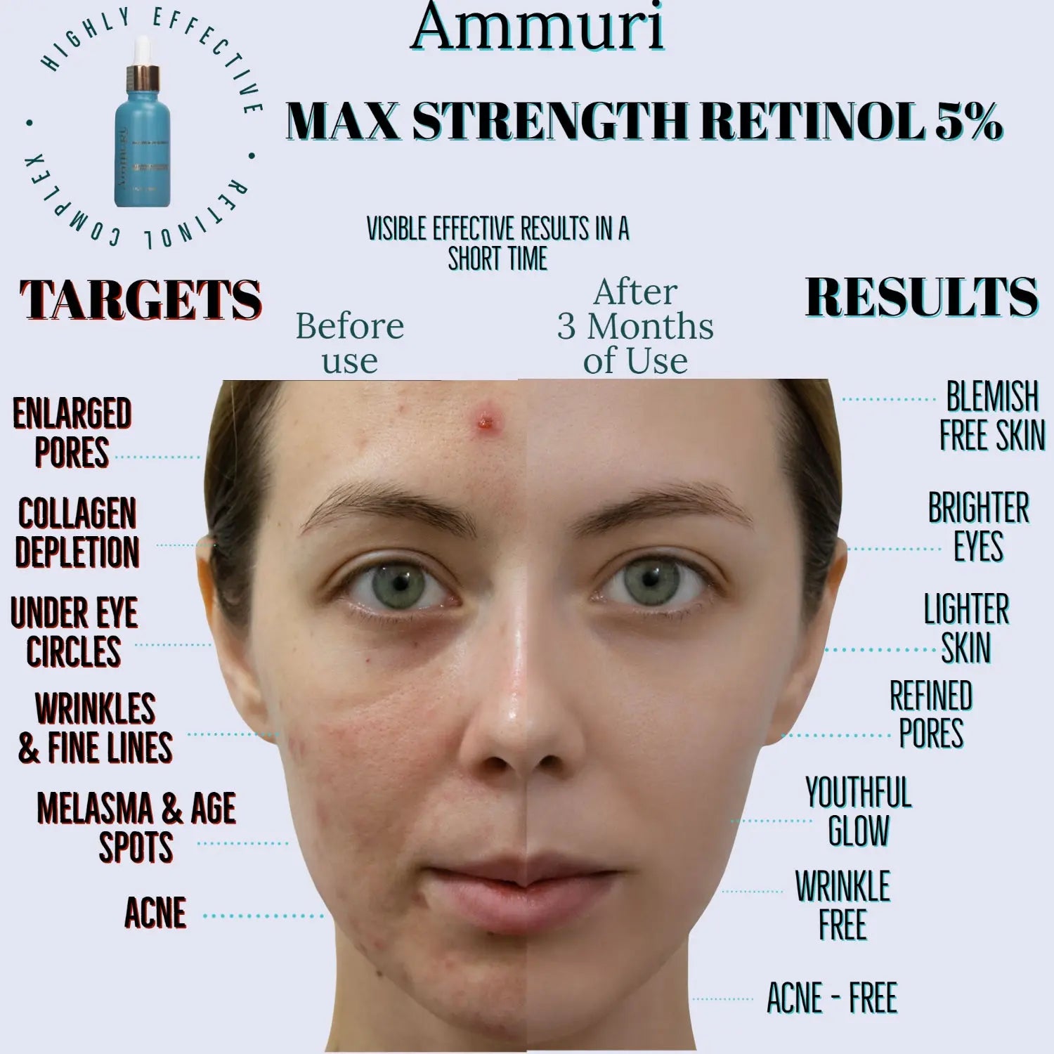 Ammuri Retinol Serum 5% (Max) Retinol Serum High Strength For Face Anti Aging Formula Face Serum For Women & Men Ammuri Skincare