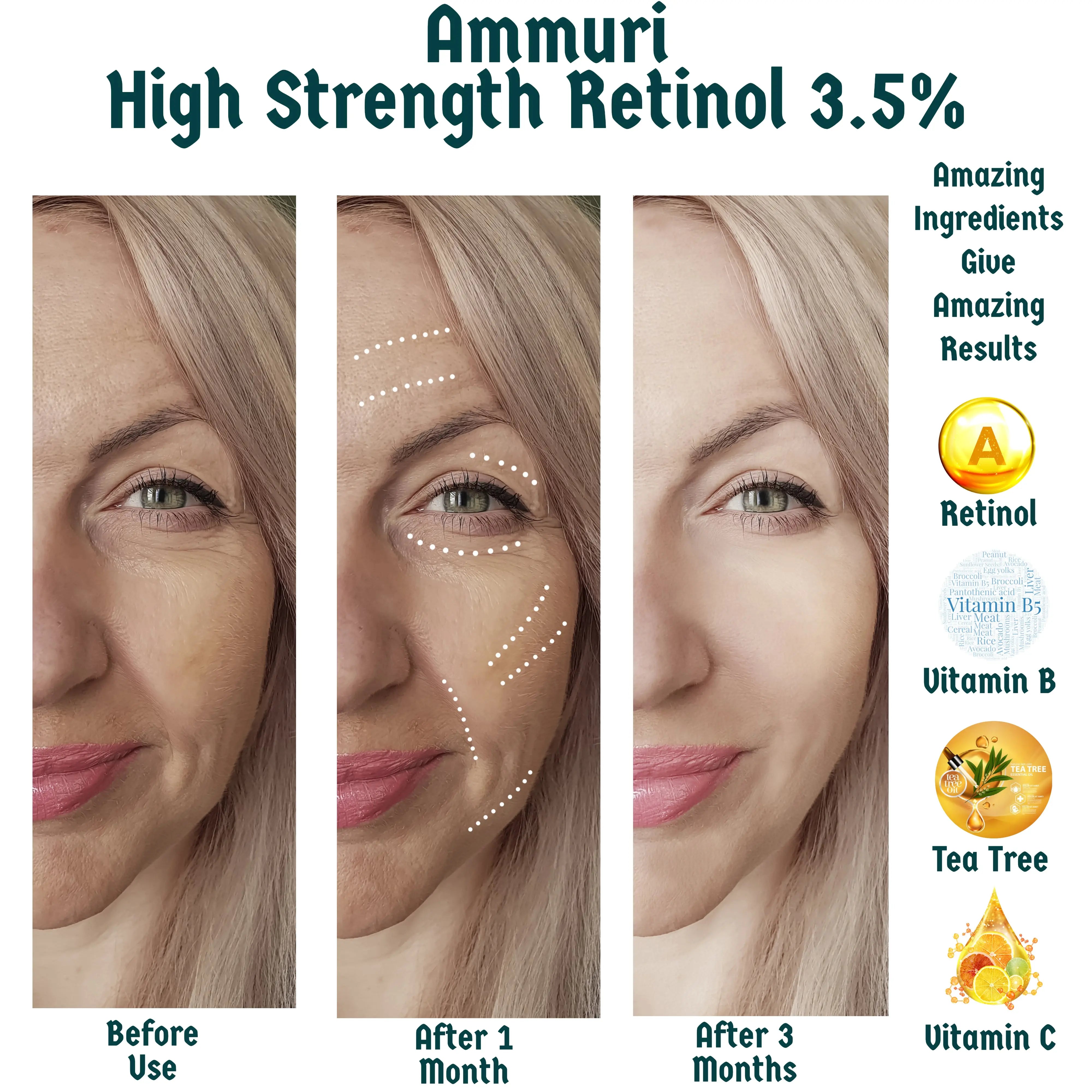 High Strength Strong Retinol Serum Anti Aging with Vitamin C Hyaluronic Acid Cream Ammuri Skincare
